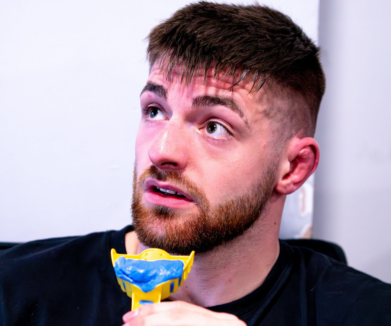 Man holding a dental impression tray  blue and yellow design, looking surprised or confused.
