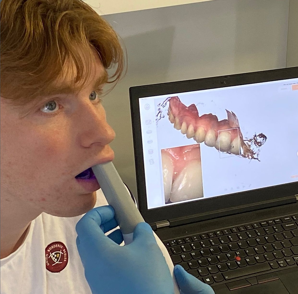 Patient having a digital scan at a dental practice